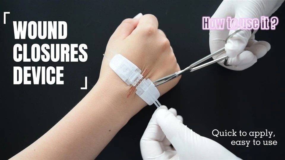 Wound Closure Device Without Suture