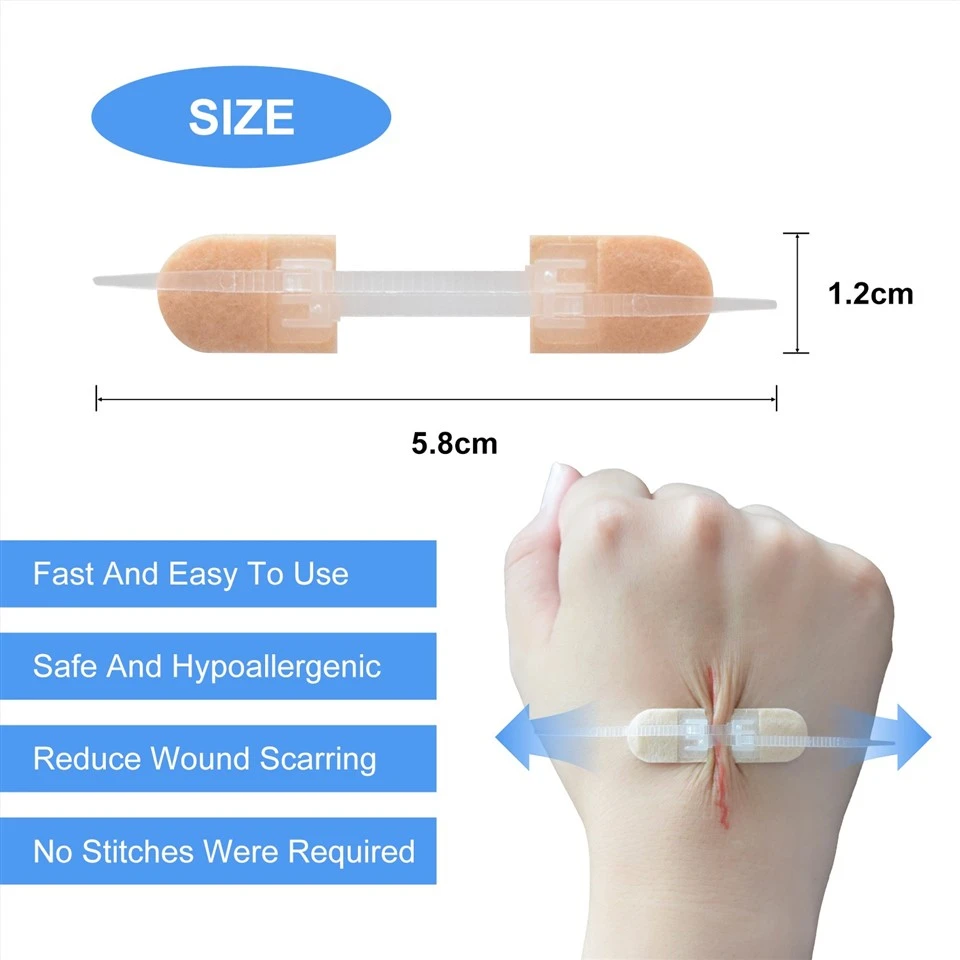 Wound Closure Device Without Suture